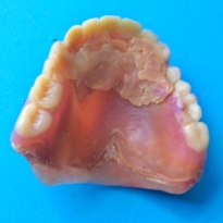 Old Denture
